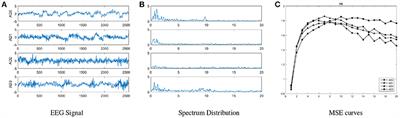 Topological Pattern Recognition of Severe Alzheimer's Disease via Regularized Supervised Learning of EEG Complexity